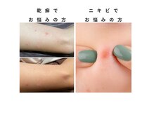 チャンティック(Cantik)の雰囲気（肌のトラブルでお悩みの方も、改善が見られます。）