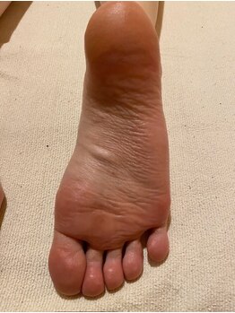 ビサンテ サロン/12)足臭・抗菌に角質育成ケア!