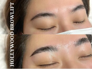 エルミュ(Elmu)/ハリウッドブロウリフト