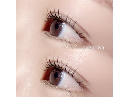 アイノワ 伏石駅前(eyenowa.)の写真