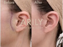 アリリィ(ARILY)/ARILY after care salon