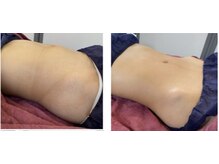 ルルン(LuLuN)の雰囲気(お腹スッキリ30分コース!ビフォーアフターです)