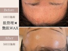 マインエム(mine.m)の雰囲気（肌管理×艶肌WAXでキメ、艶、肌トーンまで叶う当店オリジナル！）