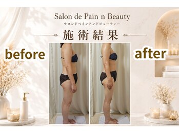【リンパ/フェイシャル/骨格調整】Salon de Pain n Beauty/施術結果！！