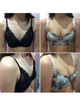 エスグレース 梅田店(S.grace)/シンデレラバストアップ施術