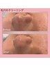 ¥韓国女優肌◆毛穴汚れごっそり/【韓国で話題】SONO 超音波ですっぴん肌に◎