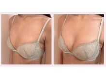 プライベートアトリエ 代官山/脇とお背中に流れたお肉をお胸に