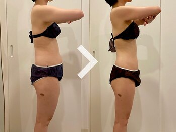 ミルズ(MillS)/ダイエットビフォーアフター