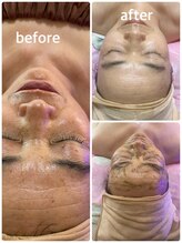 レイ(Lei)/当店のビフォーアフター