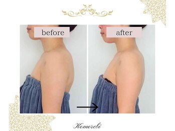 コモレビ(Komorebi)/