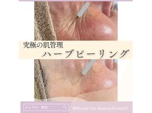 ルシアル(Rucial)の雰囲気（施術後すぐに効果実感◎お肌のメンテナンスに究極の肌管理♪♪）