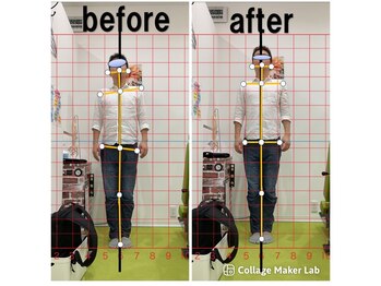 上本町骨盤整体院グッド/「整体による姿勢の変化」