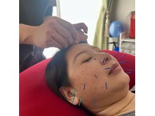 鍼灸マッサージ院 アカシア