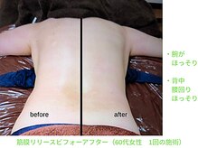 ビューティサロン オハナ(ohana)/筋膜リリースビフォーアフター