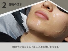 ボス 桑名店(BOSS)/施術の流れ