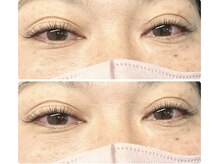 ティピ(tipi)/フラットラッシュ120本