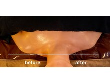 オリス(Oris)/巻き肩調整　before/after