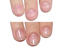 アメジスト(Amethyst)/深爪卒業！自爪育成