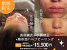 NEW！効果がすごい！和漢ピーリング+美容鍼(90分)
