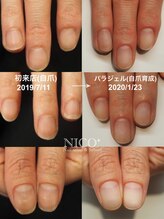 ニコプラス(NICO+)/自爪育成パラジェルクリア補強