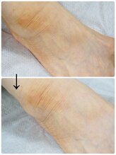 ネイル キャンバス シルヴァ(Nail Canvas Silva.)/フットもキメ細やかに！