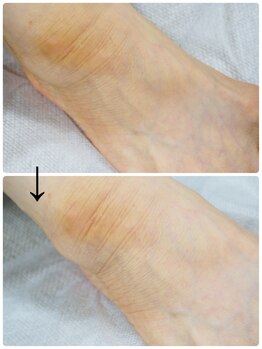 ネイル キャンバス シルヴァ(Nail Canvas Silva.)/フットもキメ細やかに!