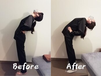 クーオス(KuuOs)/【20代/女性】1回の施術後変化