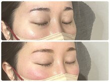 アールプラス 新宿(ar+)/【眉毛/まゆげ/アイブロウ】