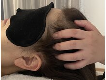 ハレ(Hare)/ヘッドスパ