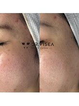 リジョイス(Rejoice)/ノアグロウフェイシャル