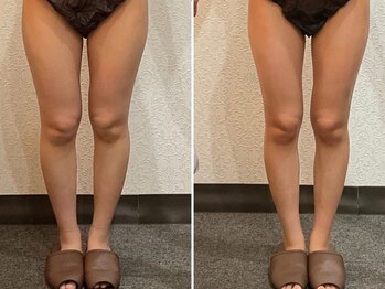 美容整体 ウェリナ 蟹江院/小顔矯正/骨盤矯正/美脚サロン