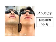 メンズビオ 神戸三宮店/