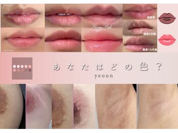 ヨウン 大阪心斎橋(yeoun)