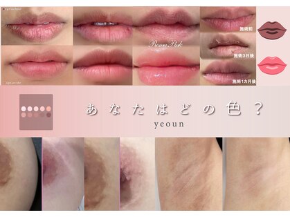 ヨウン 大阪心斎橋(yeoun)の写真