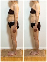 ソレイユ 北千住店(soleil)/気にしてらした下腹部の変化（2)