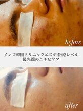 アール(R)&nbsp;韓国エステ 1回で艶肌