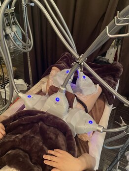 ブルースター(Blue Star)/脂肪冷却6カップ施術風景