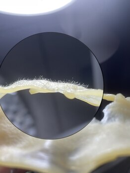 ココベラ(Cocovela)/松ヤニパック☆顔脱毛＋毛穴ケア