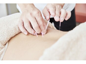 亀有成る鍼灸整骨院/鍼灸