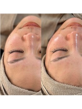 シェアリー(sharely..)/◆艶肌waxでたまご肌に