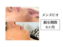 メンズビオ 神戸三宮店/