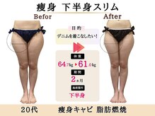 グレースエール トータルビューティーサロン(Grace Aile)/痩身【下半身スリム】