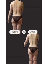 ヨサパーク ゴールデンツリー 浦安本店(YOSA PARK GordenTree)/見た目から痩せていく★