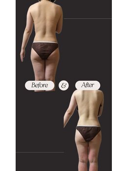 ヨサパーク ゴールデンツリー 浦安本店(YOSA PARK GordenTree)/見た目から痩せていく★