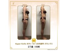 ビハース(Salon BEHARS)の雰囲気（ハイパーナイフメーカー公認の正規取扱認定店で安心の施術を。）