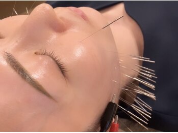 オリエンタル ルボワール(oriental Revoir)/顔鍼100本　美顔鍼　美容鍼灸