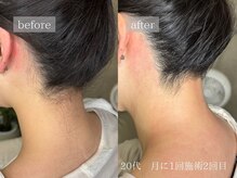 レオン(Leon)/ビフォーアフター