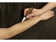 Curafin/照射漏れを防ぐ丁寧なパーツ印