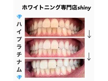 シャイニー(shiny)