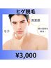 男性ヒゲ脱毛　￥３０００